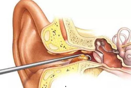 日式挖耳屎视频,轻松清洁耳朵，享受健康生活